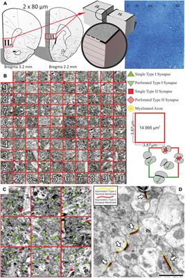 Reduced Synapse and Axon Numbers in the Prefrontal Cortex of Rats Subjected to a Chronic Stress Model for Depression